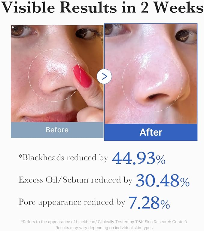 Zero Pore Pad 2.0 70 Pads