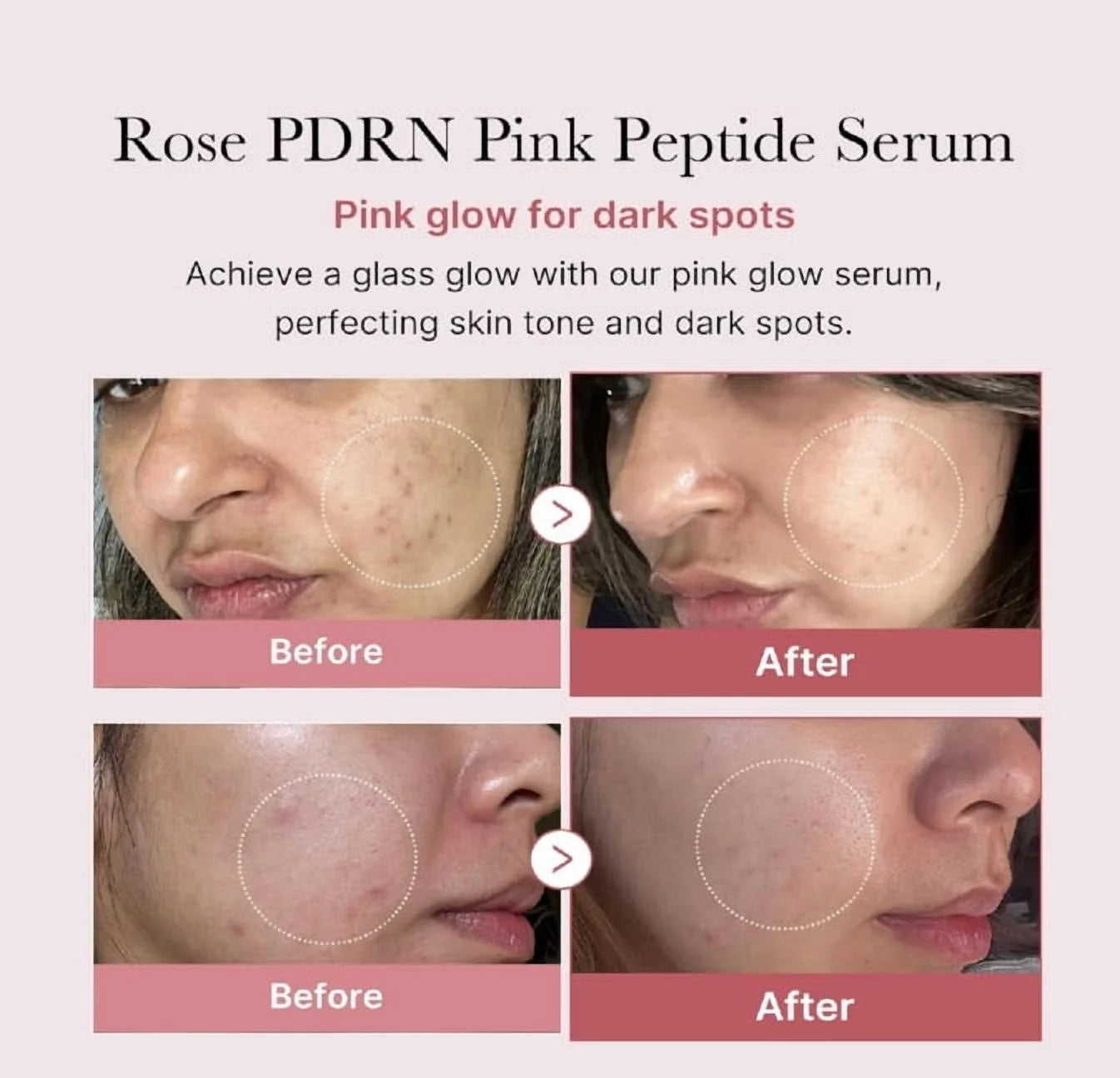 Revitalize Your Skin with Medicube PDRN Pink Peptide Serum - 30ml of Youthful Radiance